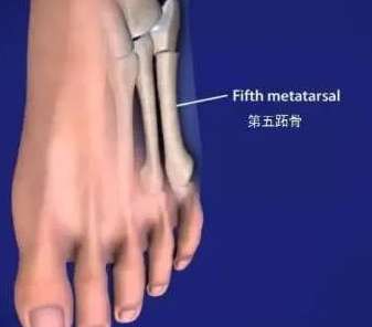 足下生风亦会折，NBA 历史上遭遇跖骨骨折的球星们
